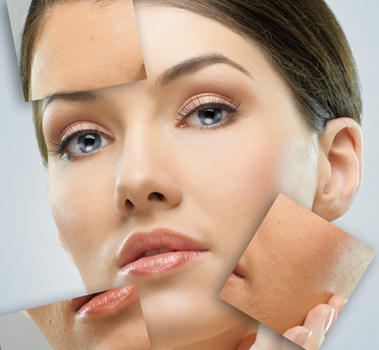 Điều trị thâm da mặt bằng phương pháp đơn giản tại nhà