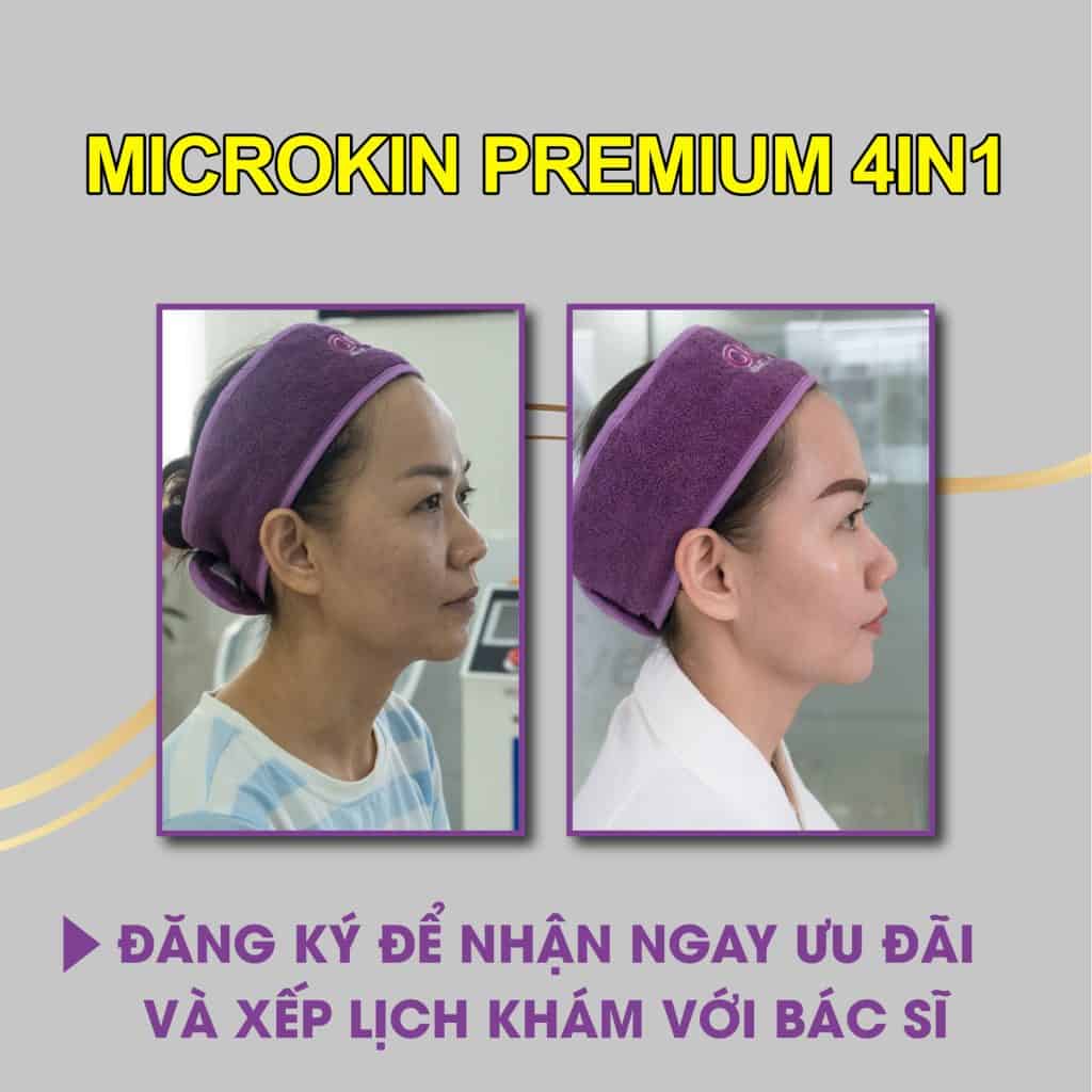 MicroSkin Premium 4in1