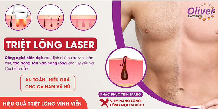 Triệt lông vĩnh viễn cho nam giới bằng công nghệ Laser tại Oliver
